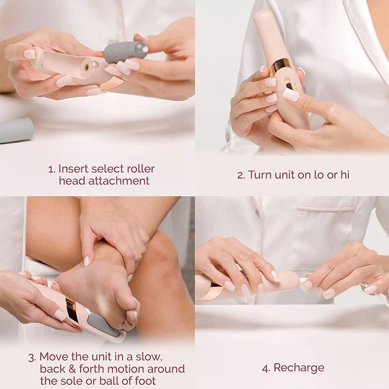 SoftFeet Callus Remover