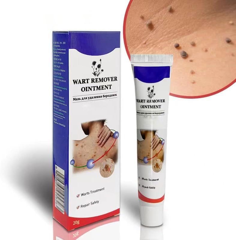 Warts Remover Ointment – Fast, Gentle &amp; Effective Treatment for Warts