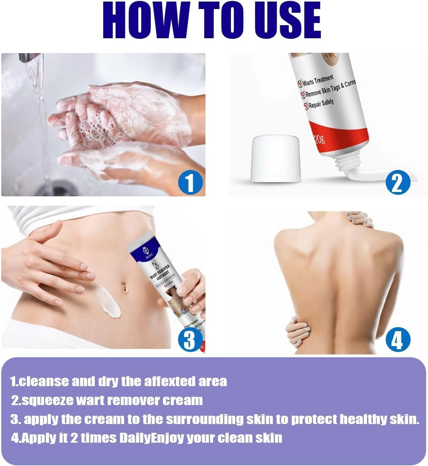 Warts Remover Ointment – Fast, Gentle &amp; Effective Treatment for Warts