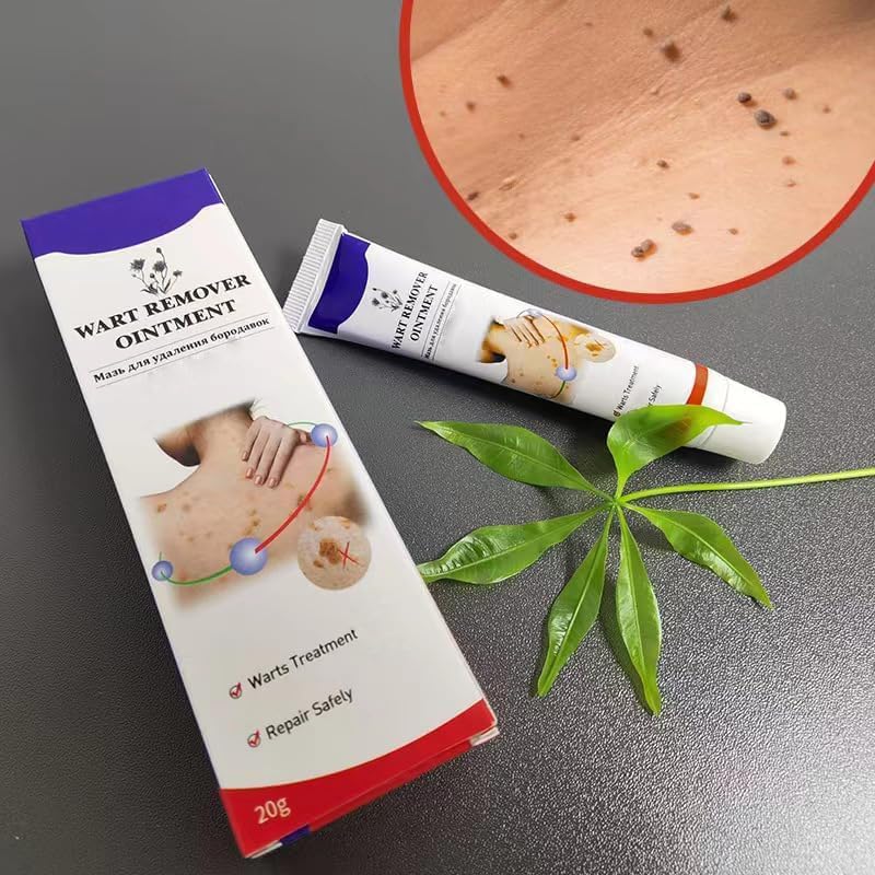 Warts Remover Ointment – Fast, Gentle &amp; Effective Treatment for Warts